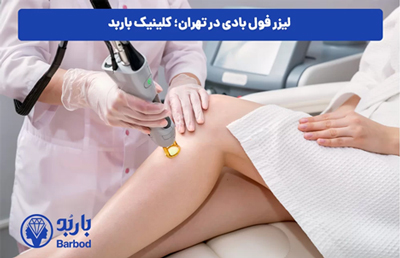 تهران | لیزر