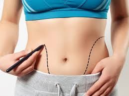 The difference between liposuction and liposuction