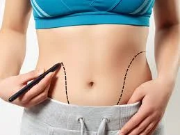 The difference between liposuction and liposuction