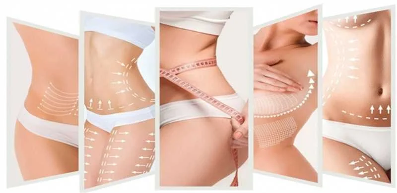 Complications after body sculpting