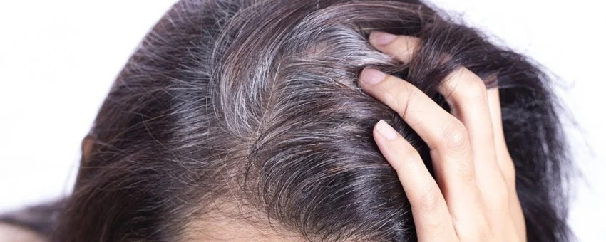 Zero to one hundred ways to prevent hair loss