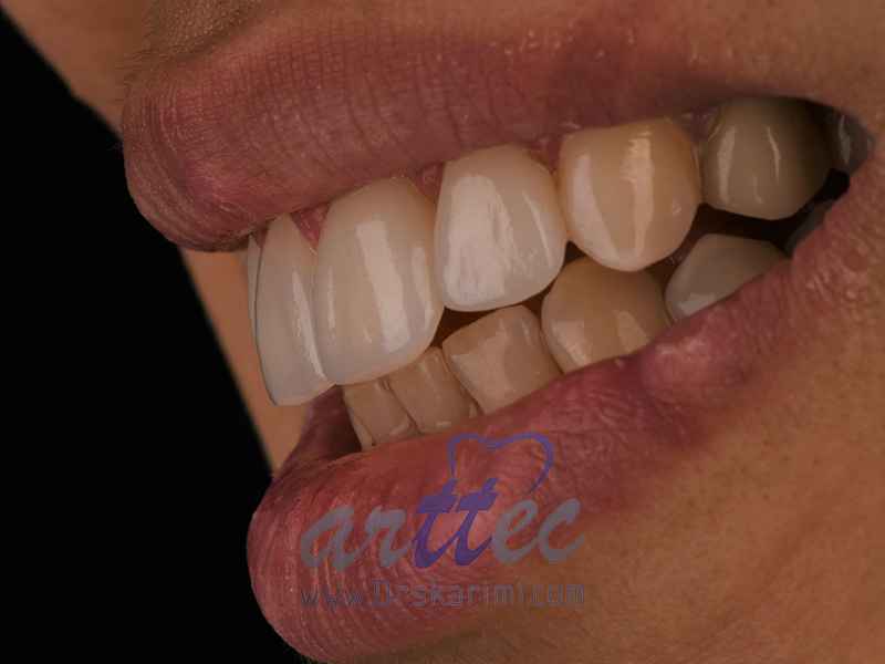 Traditional medicine to prevent tooth decay