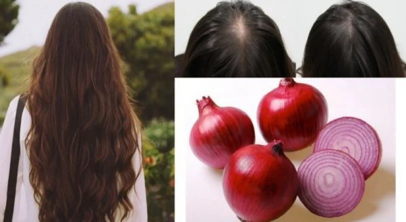 Onion juice to treat hair loss + how to use