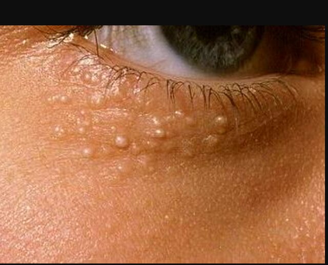 اینفوگرافیک/ از میلیا چه میدانید؟ اینفوگرافیک/ از میلیا چه میدانید؟
