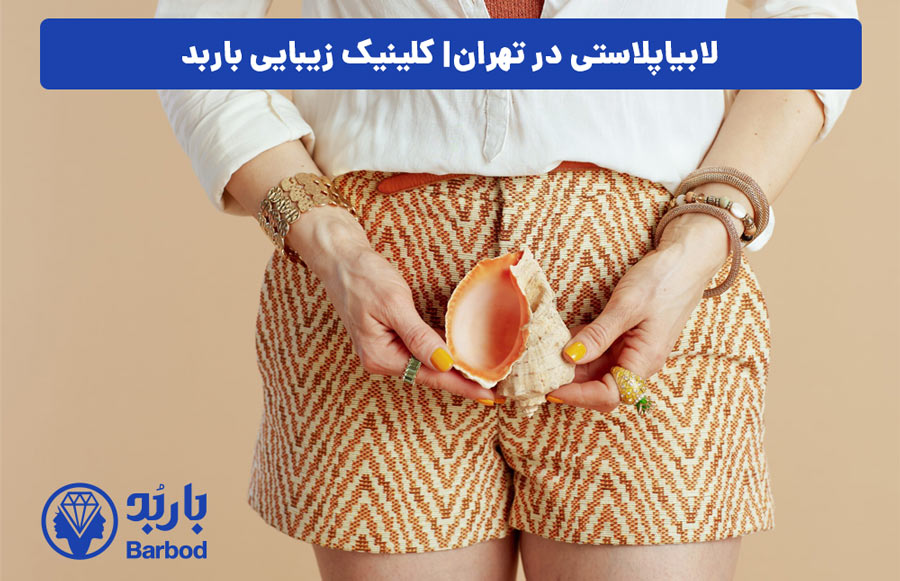اپل | تهران