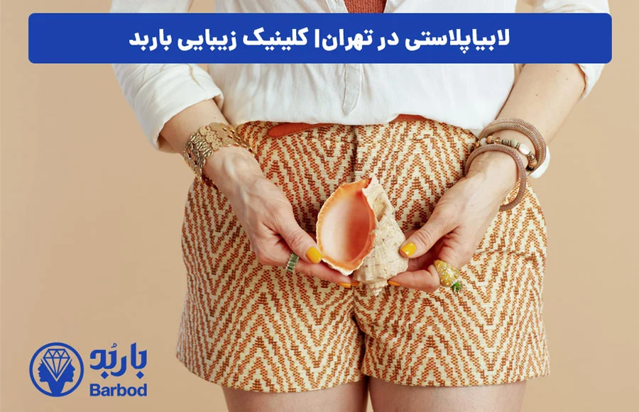 اپل