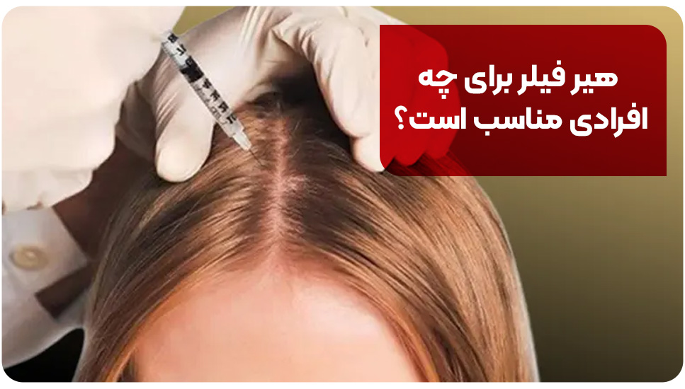 هیر فیلر برای چه افرادی مناسب است؟