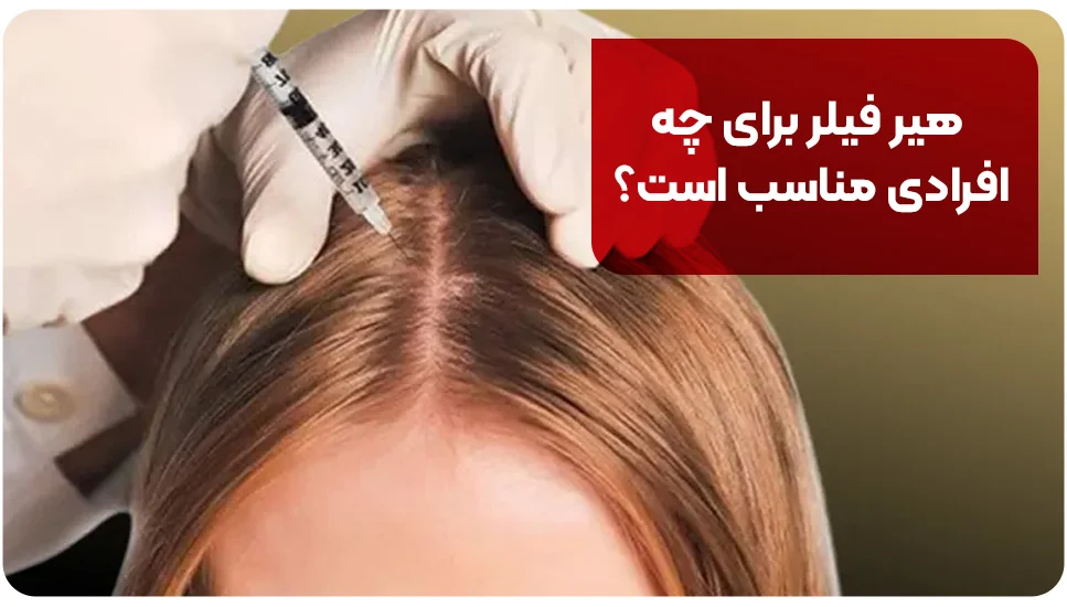 هیر فیلر برای چه افرادی مناسب است؟