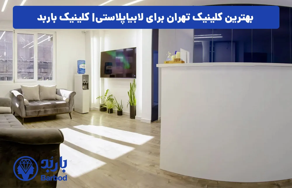 اپل | تهران