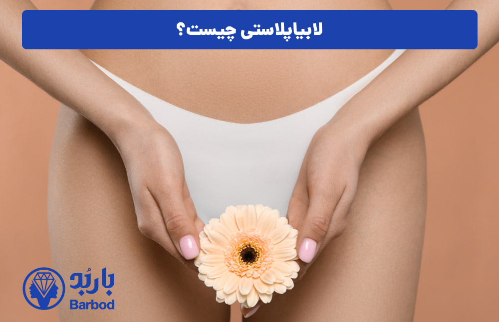 اپل | تهران