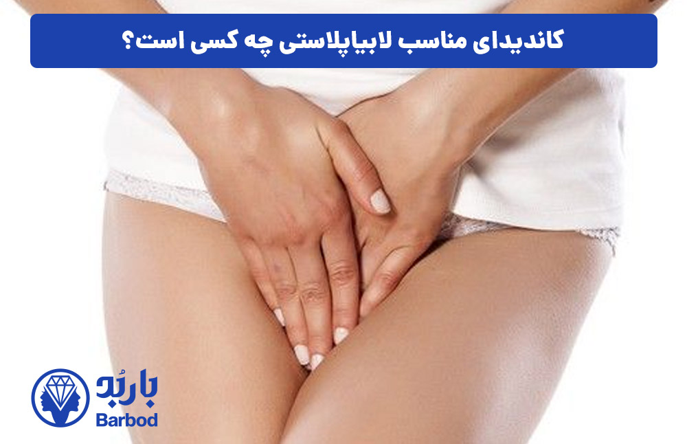 اپل | تهران