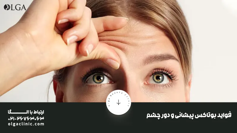 بوتاکس | پوست | تزریق بوتاکس فواید بوتاکس دور چشم و پیشانی